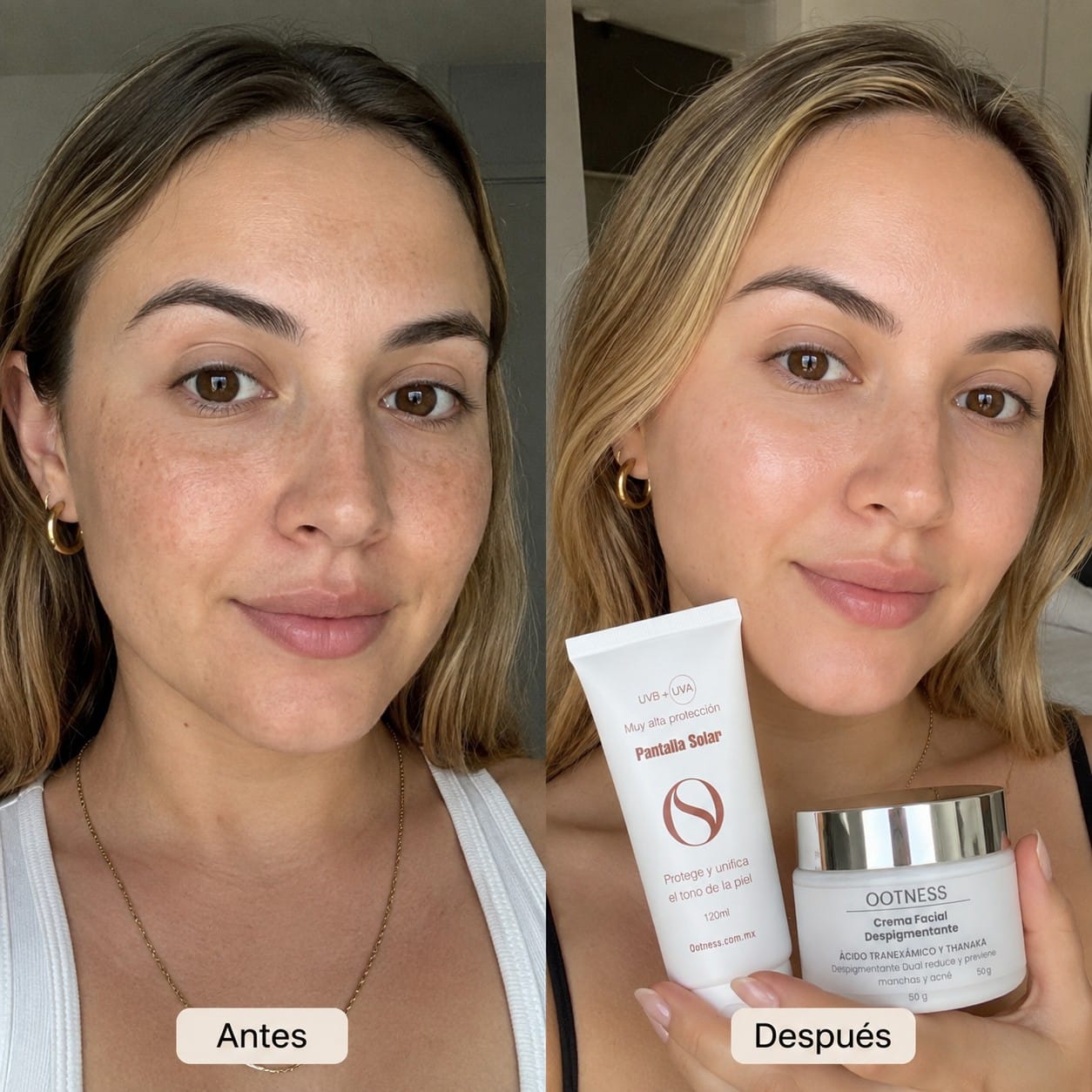 Antes y despu&eacute;s: Elena, Kit Piel Sin Manchas Ootness